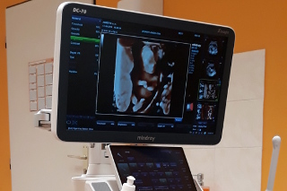 ultrazvuk